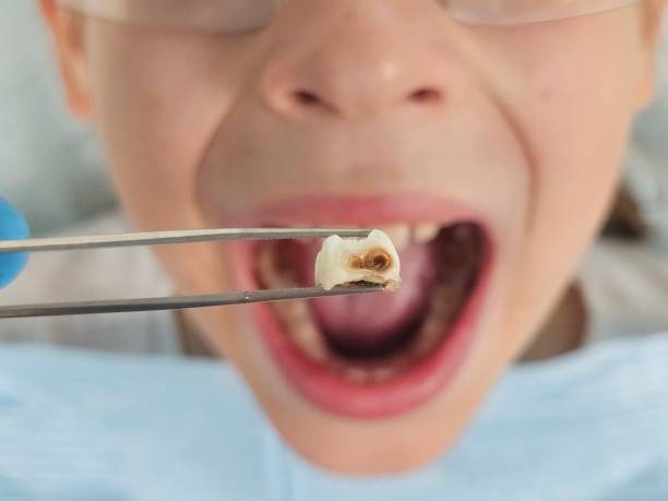 Best Pediatric Emergency Dentist in Belle Fourche, SD